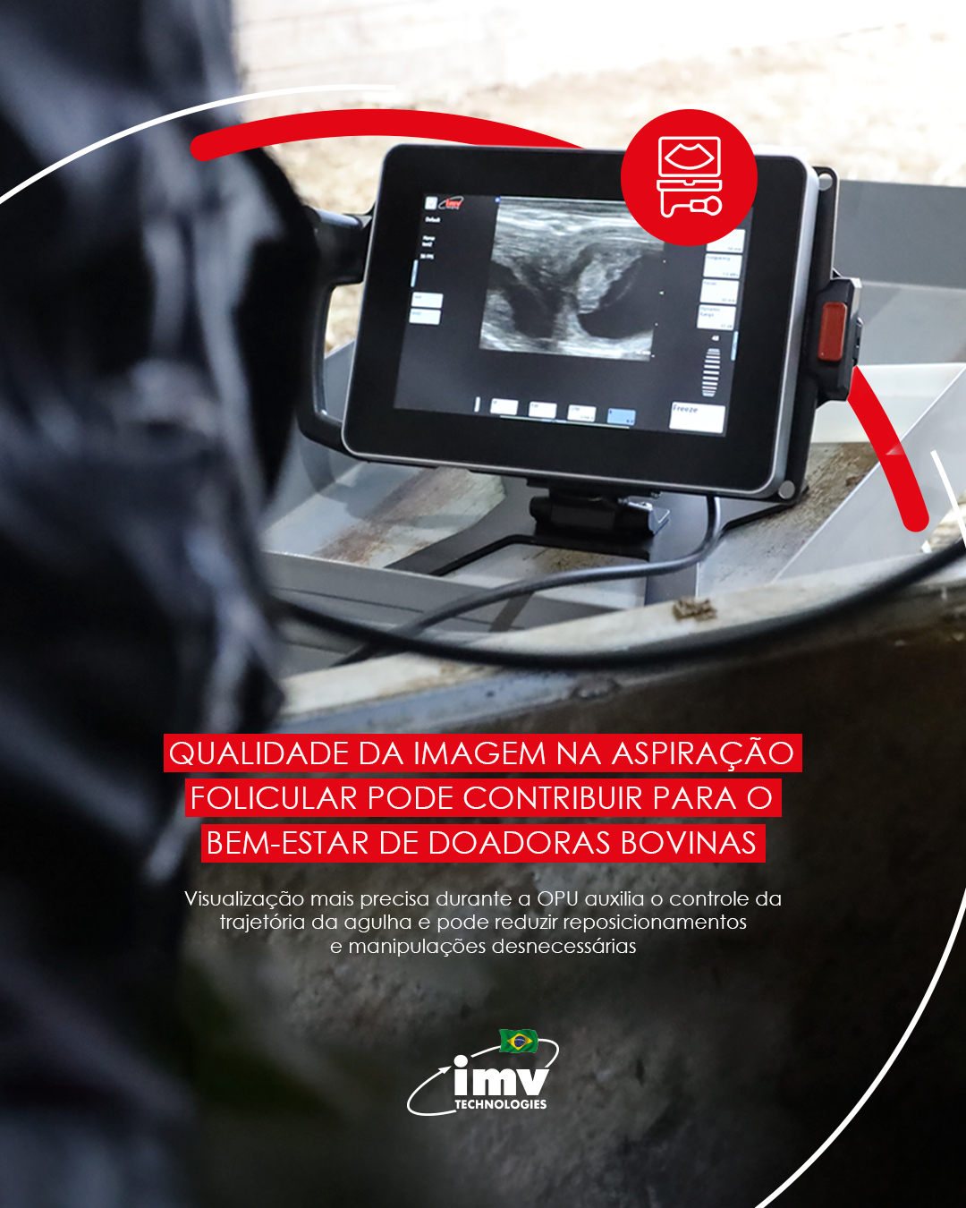 Qualidade da imagem na aspiração folicular pode contribuir para o bem-estar de doadoras bovinas