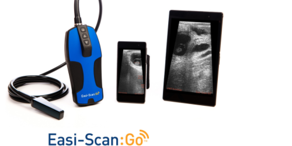 Ultrassom Easi-Scan:Go e software de inteligência artificial